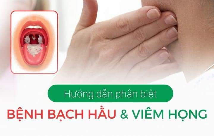 HƯỚNG DẪN PHÂN BIỆT  BỆNH BẠCH HẦU VÀ VIÊM HỌNG THÔNG THƯỜNG